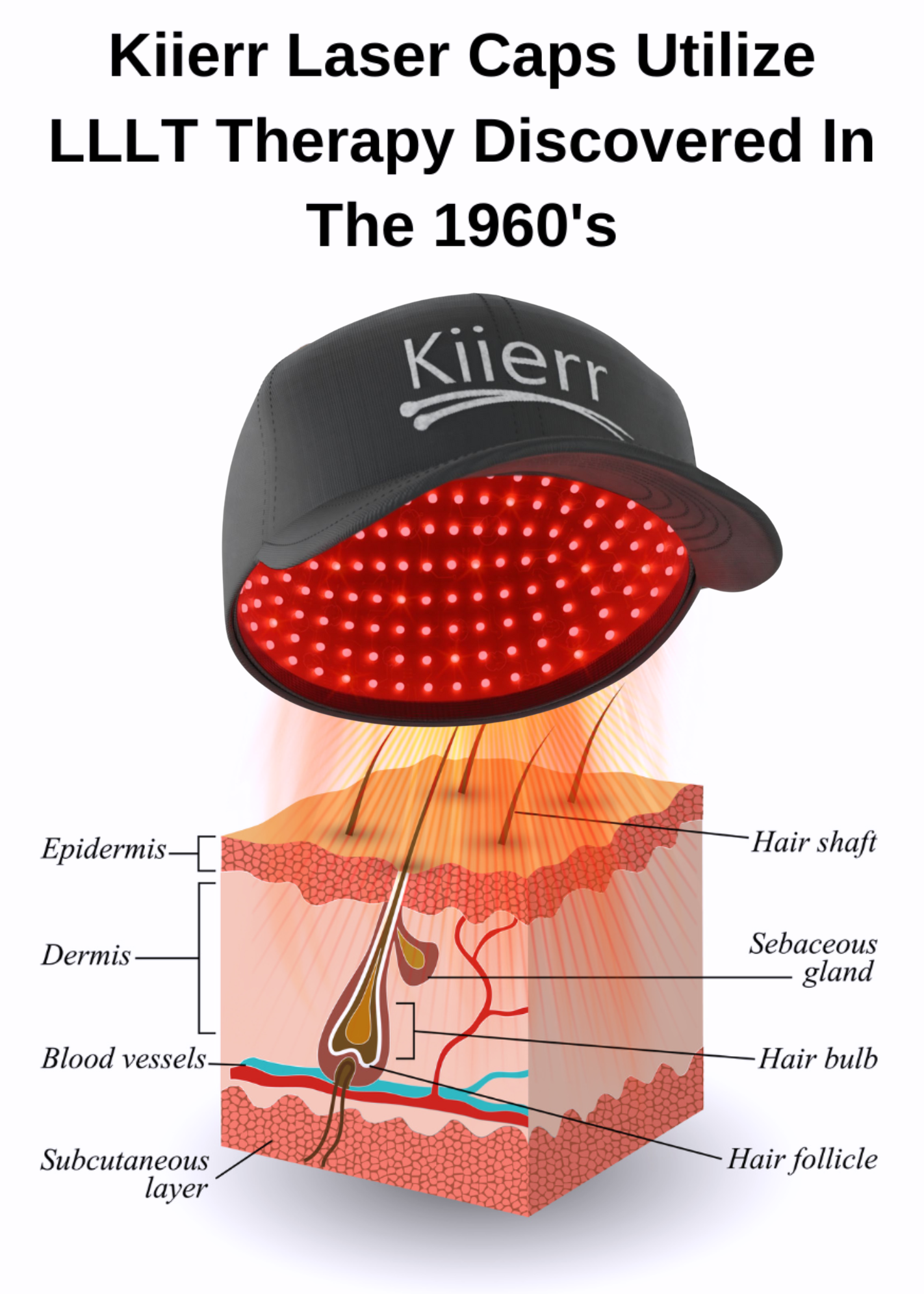 Kiierr laser ca- how it works image